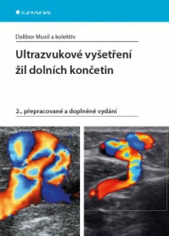 Ultrazvukové vyšetření žil dolních končetin 2., přepracované a doplněné vydání 