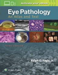Eye pathology, an atlas and text, 3rd edition