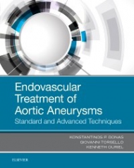 Endovascular Treatment of Aortic Aneurysms, 1st Edition