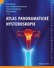  Atlas panoramatické hyteroskopie