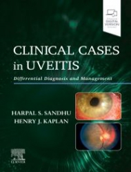 Clinical Cases in Uveitis, 1st Edition