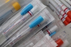 Virolog Grubhoffer: Neopouštějme testování. Prohlásit bezinfekčnost tři týdny po očkování je unáhlené