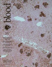 Blood