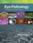 Eye pathology, an...