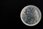 Zlínští vědci můžou zbavit nemocnice bakterií