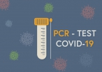 Fiala: Je logické, že stát preventivní PCR testy nebude platit, když je nežádá