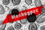 WHO vyhlásila nejvyšší stupeň varování kvůli opičím neštovicím